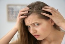 Photo of Balding Problems with Men and Women