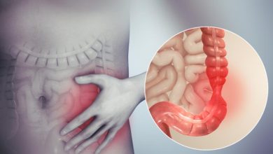 Photo of What Is Irritable Bowel Syndrome? Causes and Care Options
