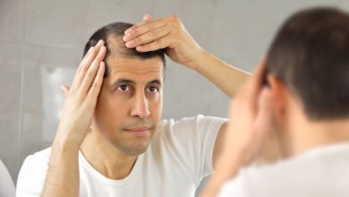 Photo of Facing Hair Loss? Try This